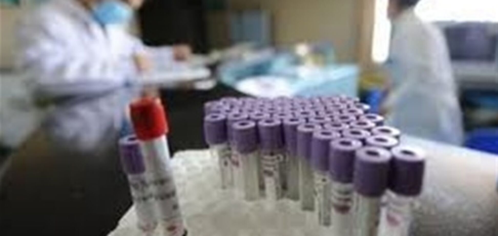 Житомир. 12 дітей потрапили до лікарні з кишковою інфекцією