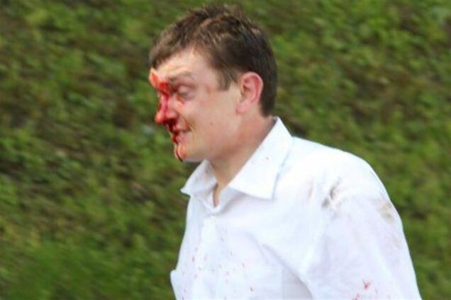 Очевидец: львовян спровоцировали на конфликт криками 'Хохлы - параша! Победа эта наша!'