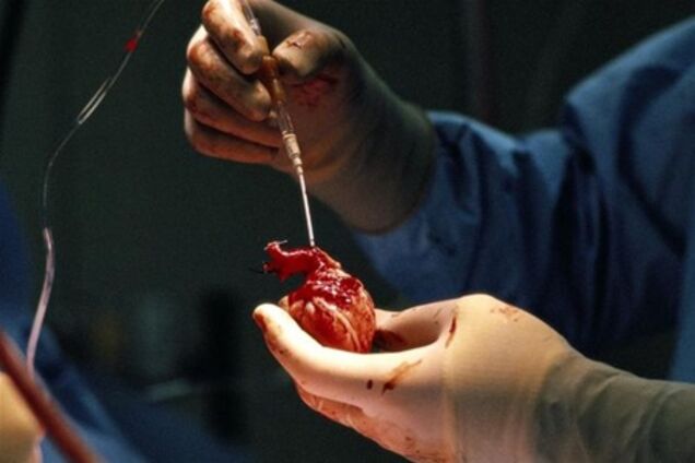 МИД: Лидером 'черных трансплантологов' был израильтянин