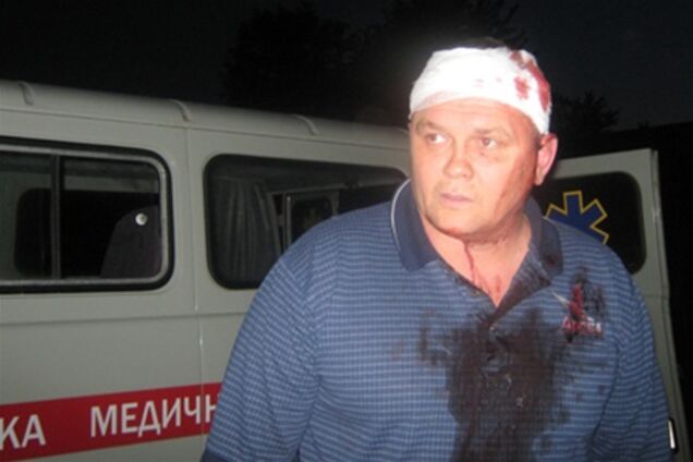 Люди стояли на смерть, захищаючи свій цукровий завод