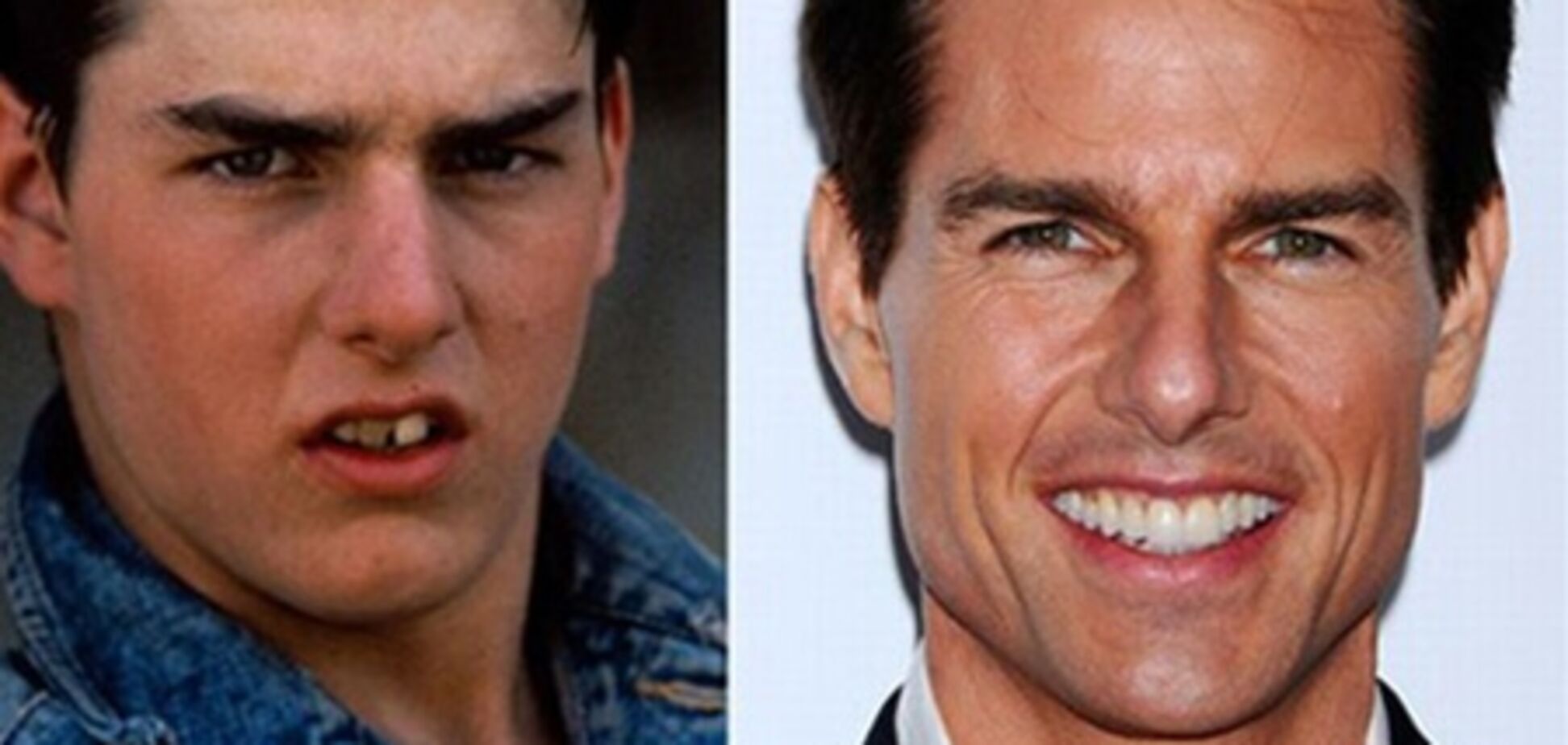 Голлівудські зірки до і після стоматолога.Фото