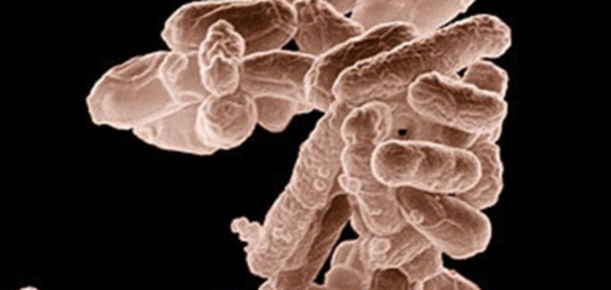 Спалах в ФРН кишкова інфекція призвела до перших смертям