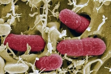 Заражені кишковою інфекцією овочі виявлені в Чехії, Австрії та Угорщини