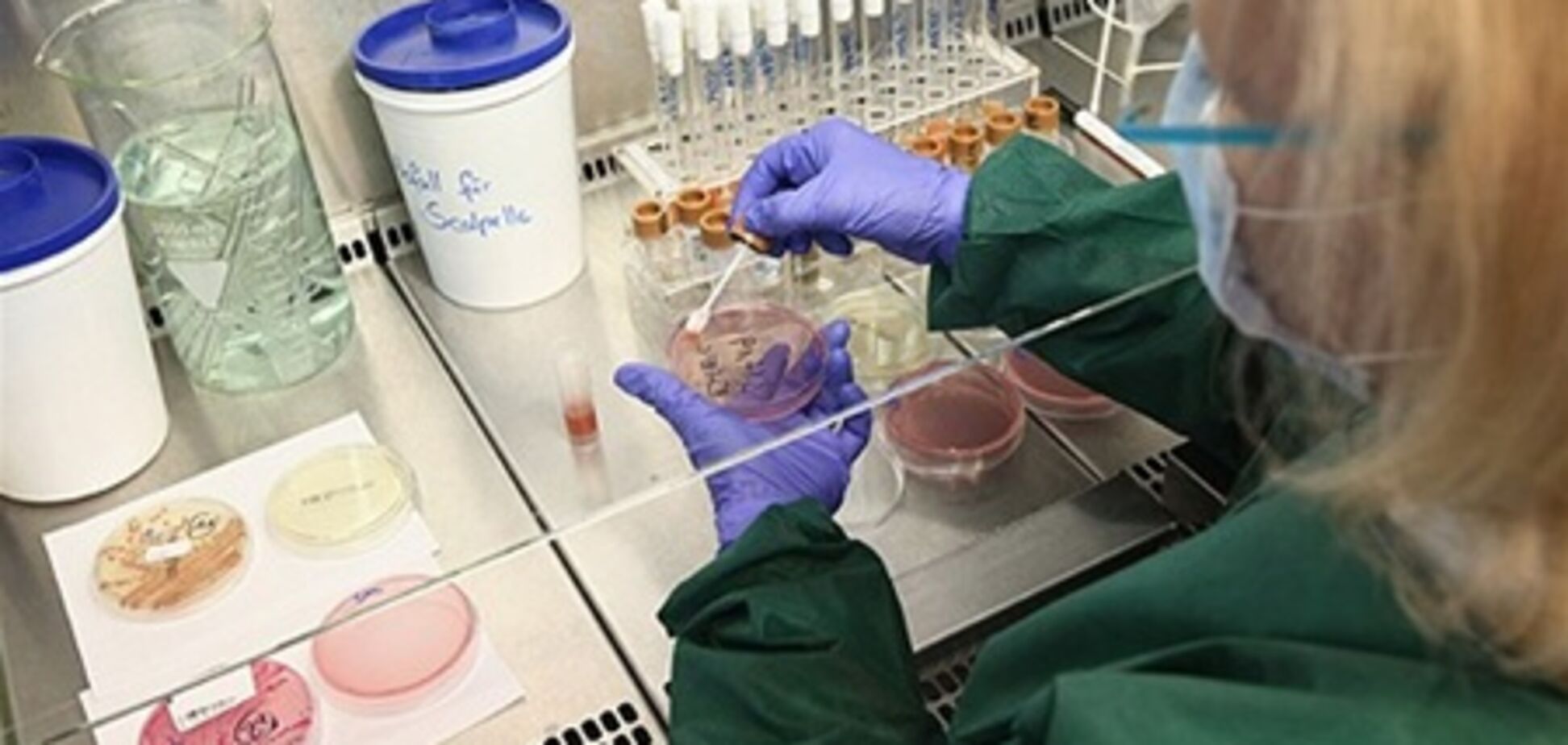 У Німеччині перевіряють нове джерело кишкової інфекції