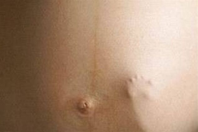 Вагітним треба спати на лівому боці