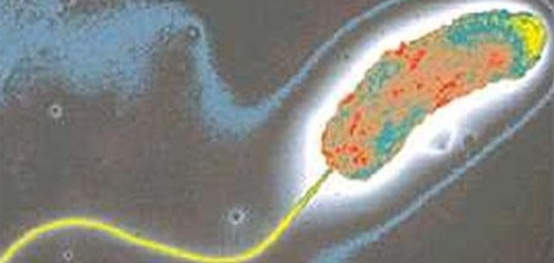 В Афганистане заболевших холерой исчисляют тысячами