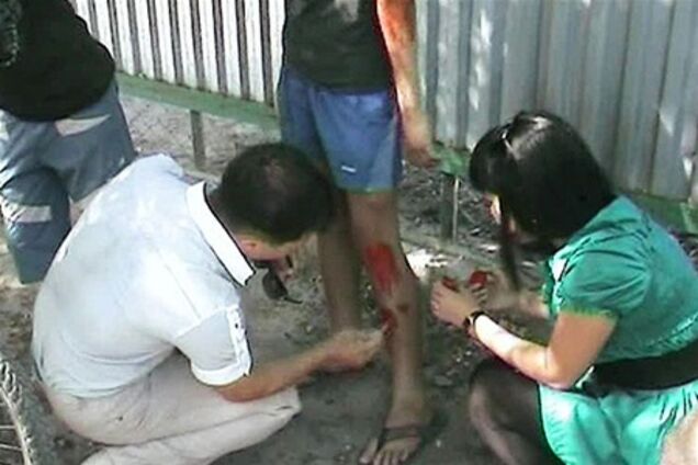 Даішники влаштували провокацію, кинувши 'закривавленого хлопчика' на дорозі