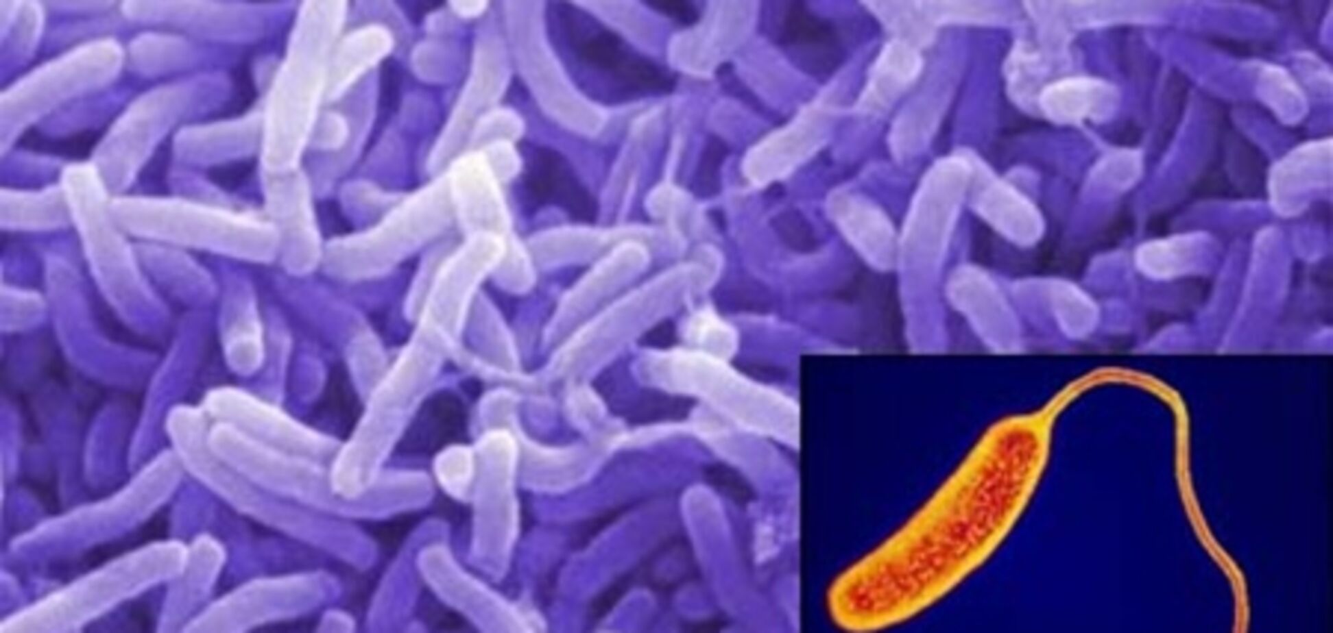 Иран пал жертвой холеры