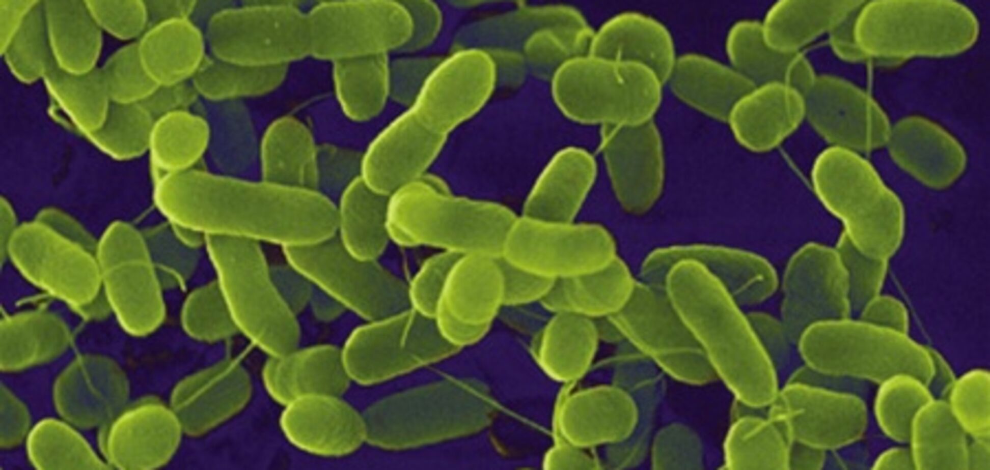 Бактерию E.coli обнаружили уже в Бразилии