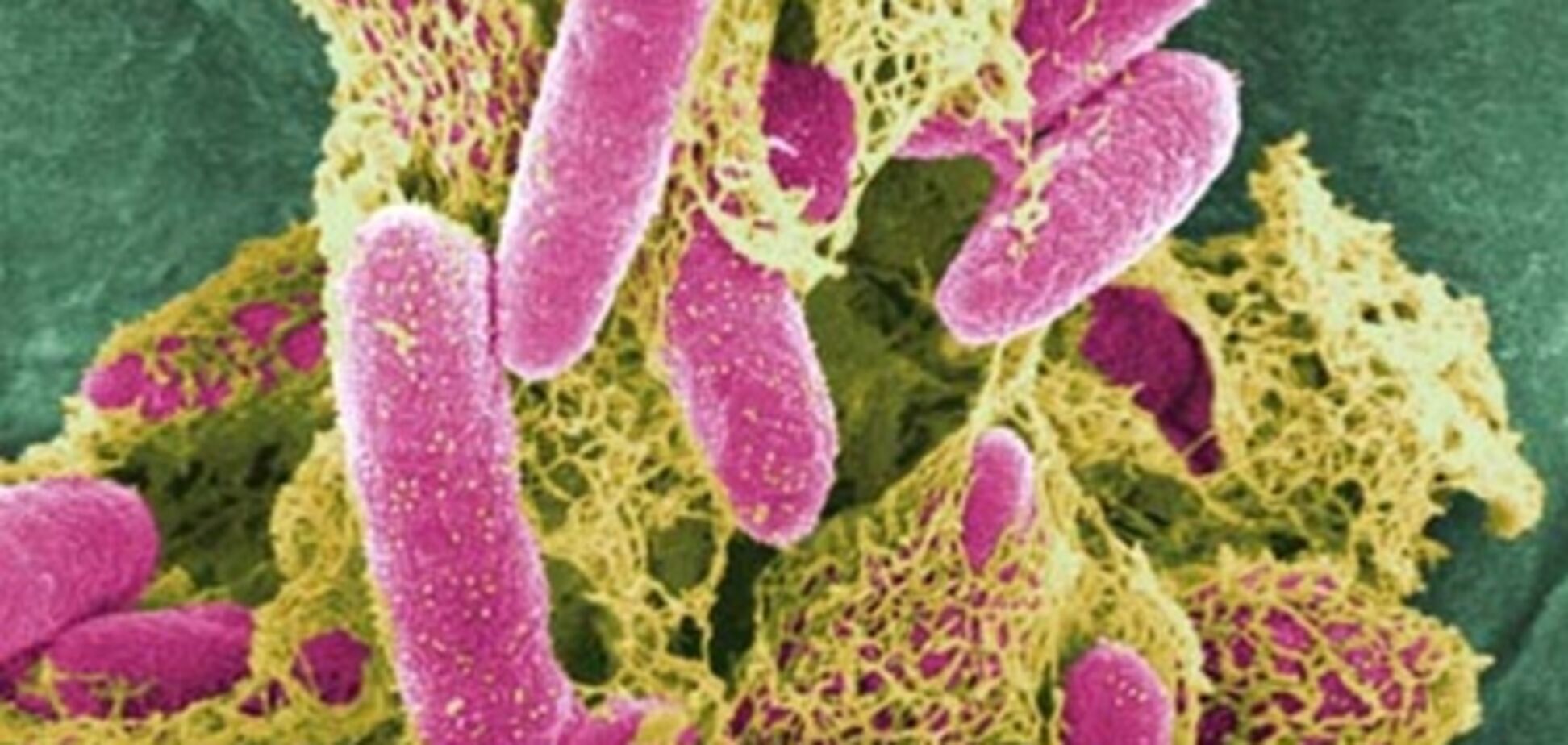 Кишечная инфекция E.coli добралась до Египта