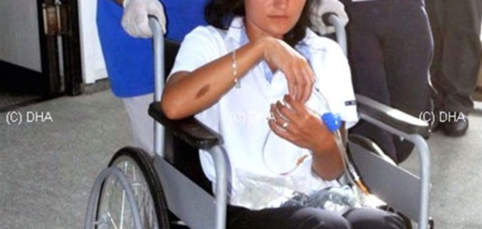 Отравившиеся в Турции россияне могли из-за метанола ослепнуть