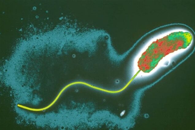 Холера в Мариуполе продолжает косить людей: 14 заболевших
