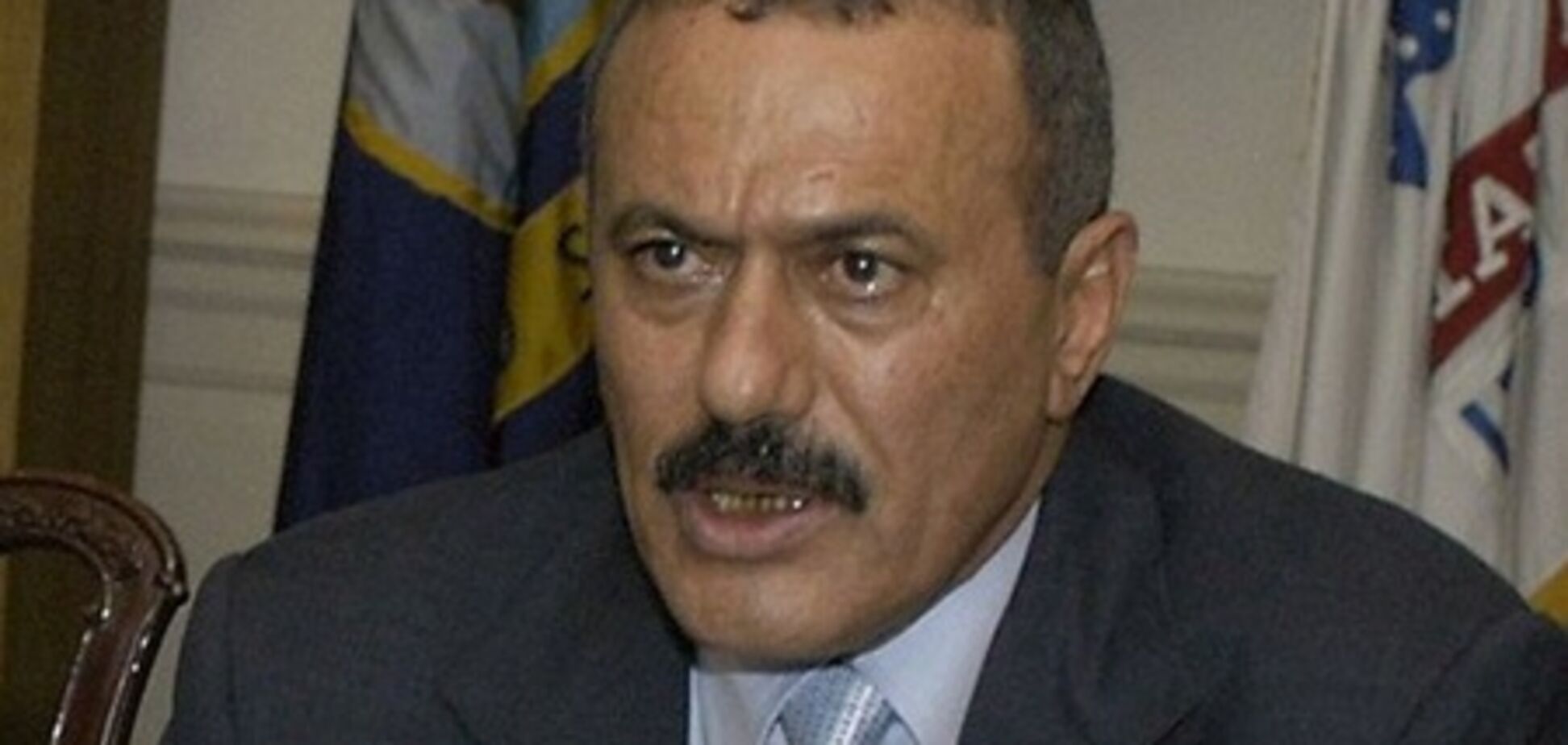 Президент Йемена, раненный в ходе обстрела, получил 40% ожогов тела