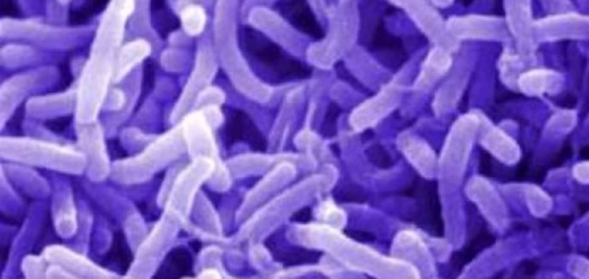 Холеру уже обнаружили в Запорожье