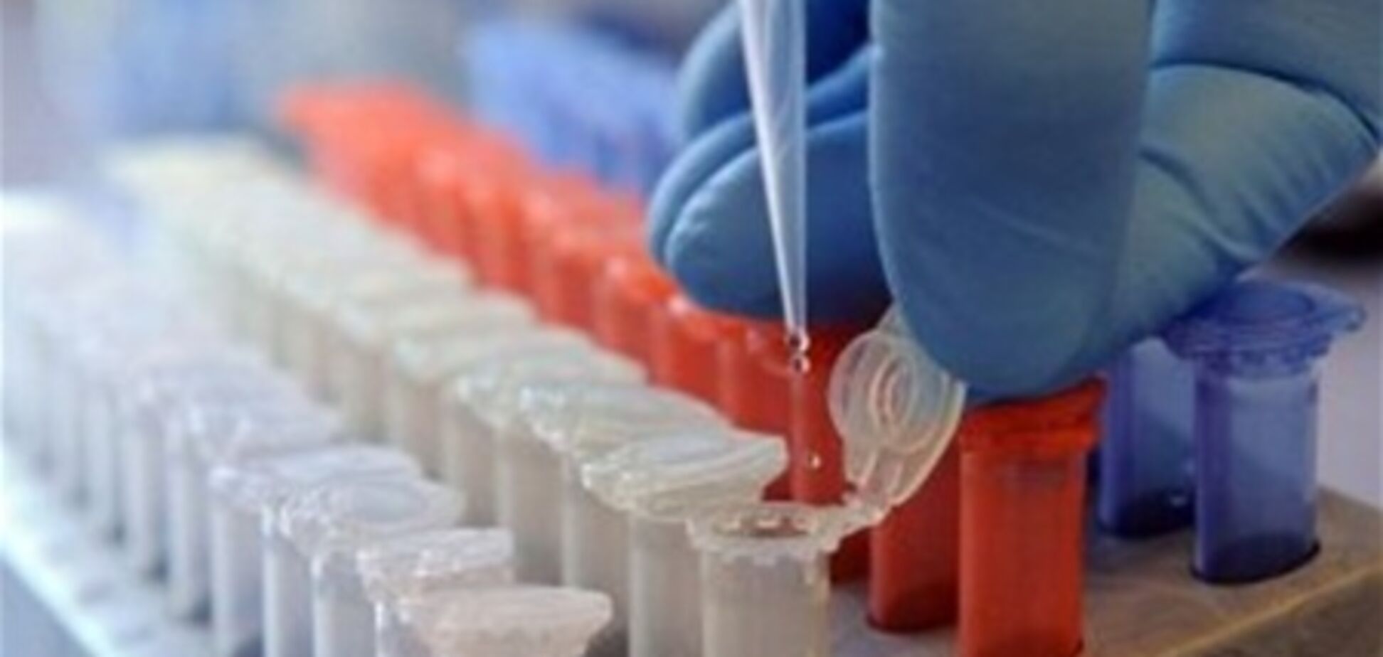 В Германии зафиксированы еще два случая гибели от острой кишечной инфекции