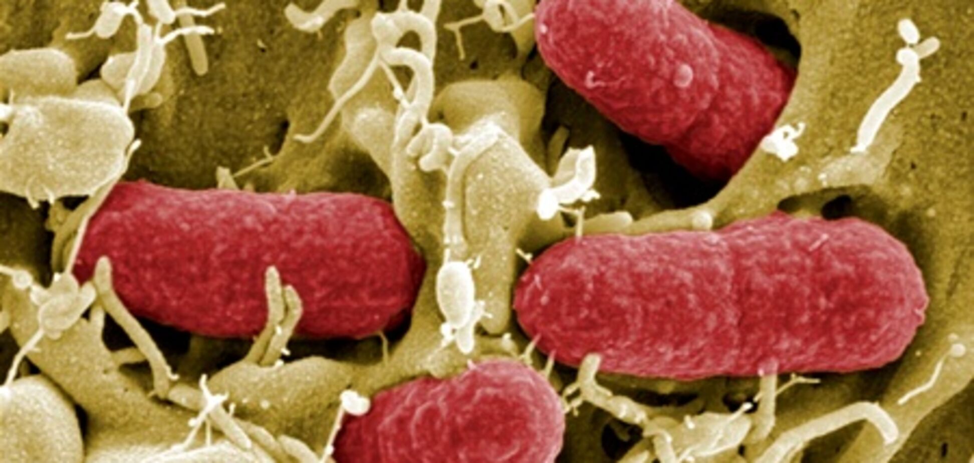 ЕС может отомстить России за реакцию на кишечную эпидемию