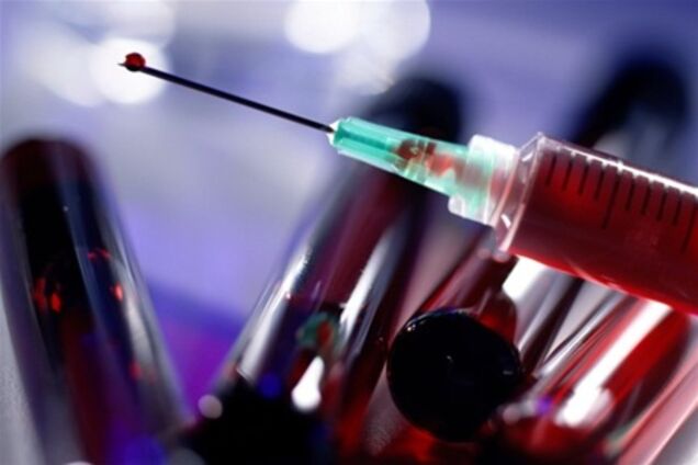 СНІД лікується - доведено американцем