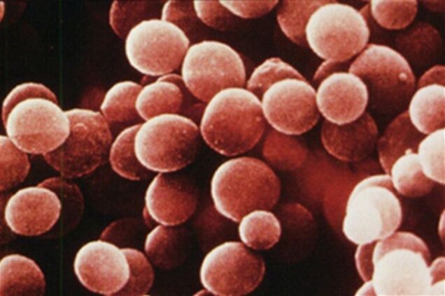 Відпочинок з присмаком стафілокока