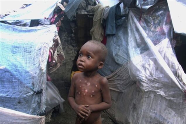 ООН: в Сомали голодают почти 4 млн жителей