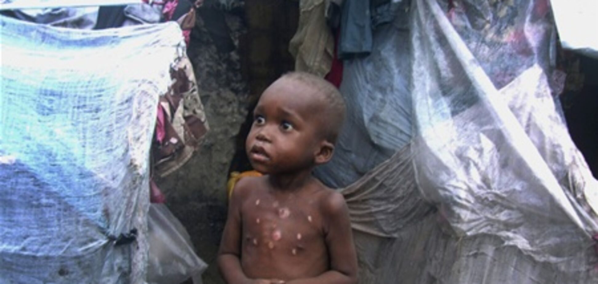 ООН: в Сомали голодают почти 4 млн жителей