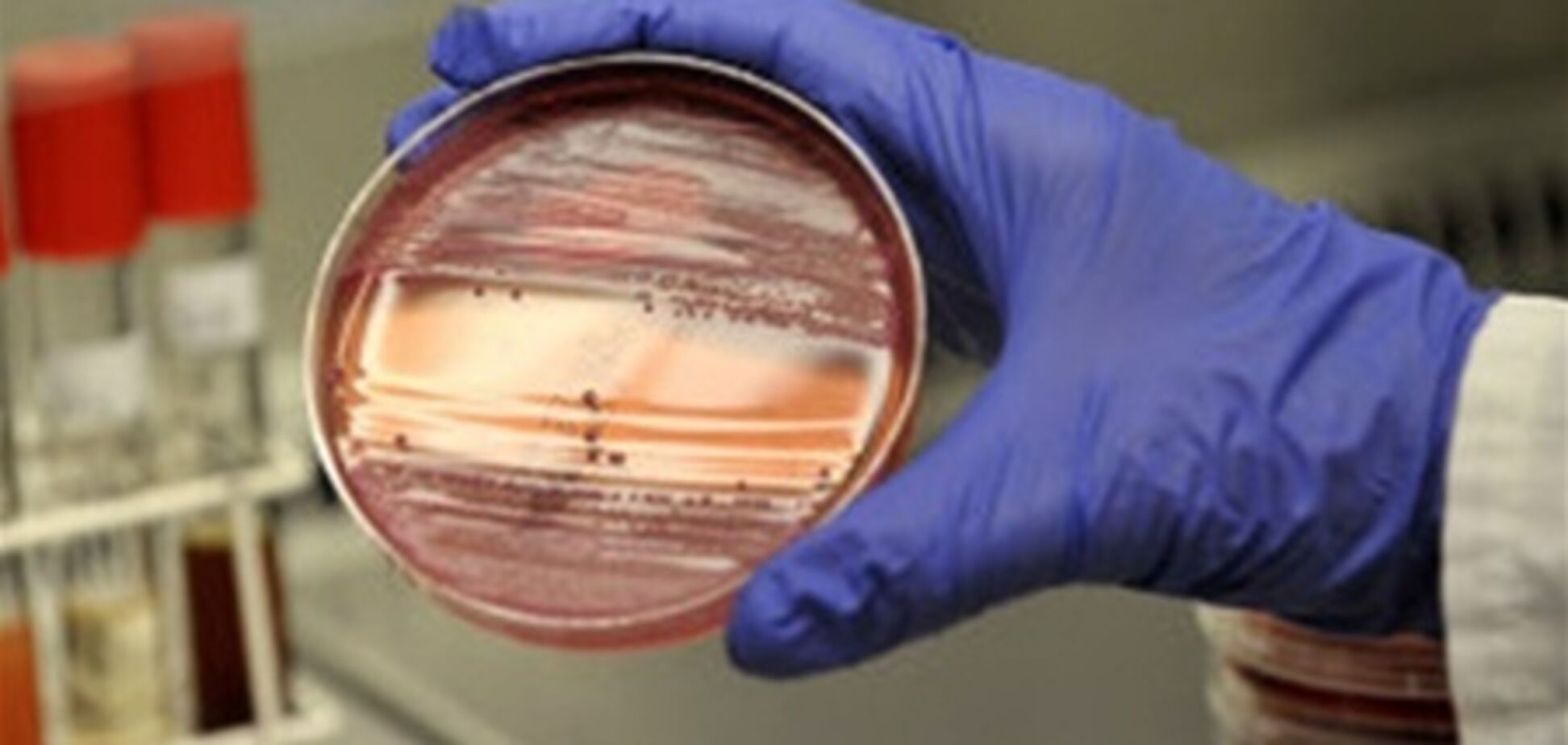 В Германии объявили о завершении эпидемии кишечной инфекции