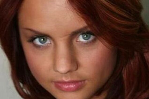 Шрамы знаменитостей. Фото