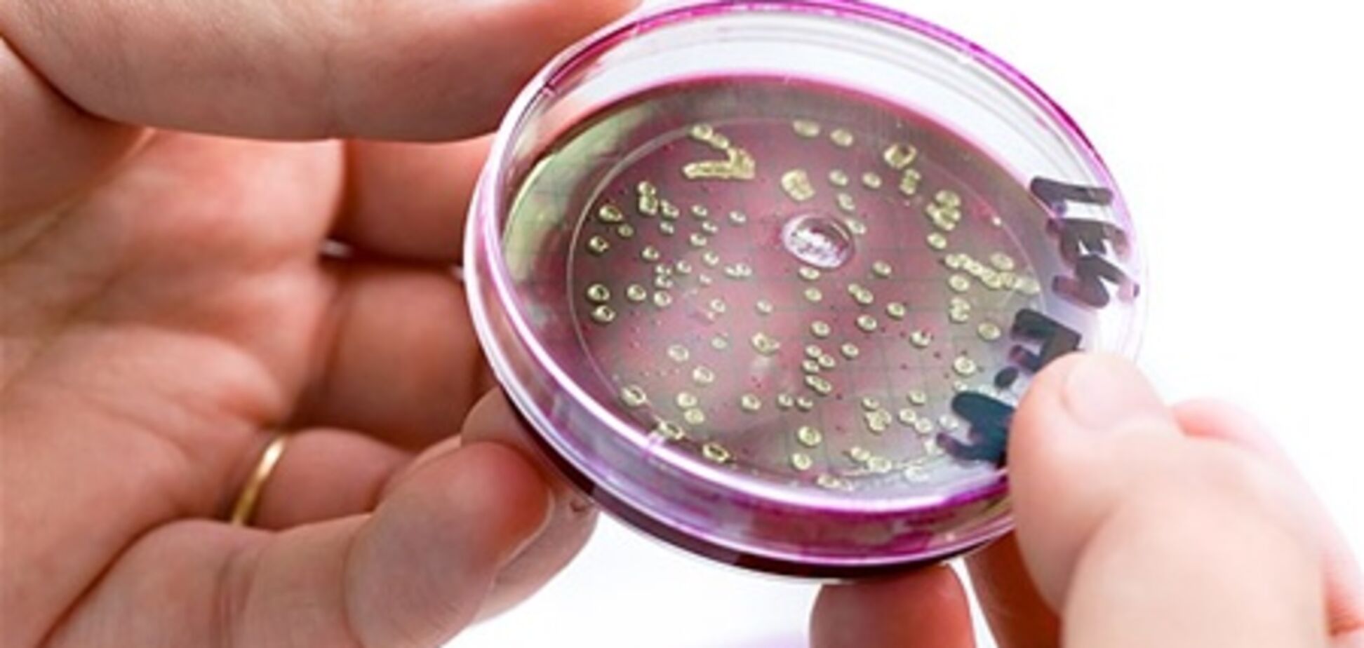 Кишкова паличка E.coli передається від людини до людини