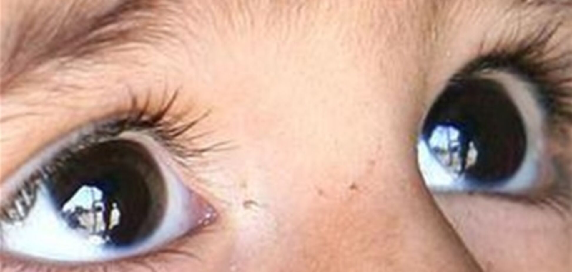 Восьмирічний харків'янин випав з вікна третього поверху школи