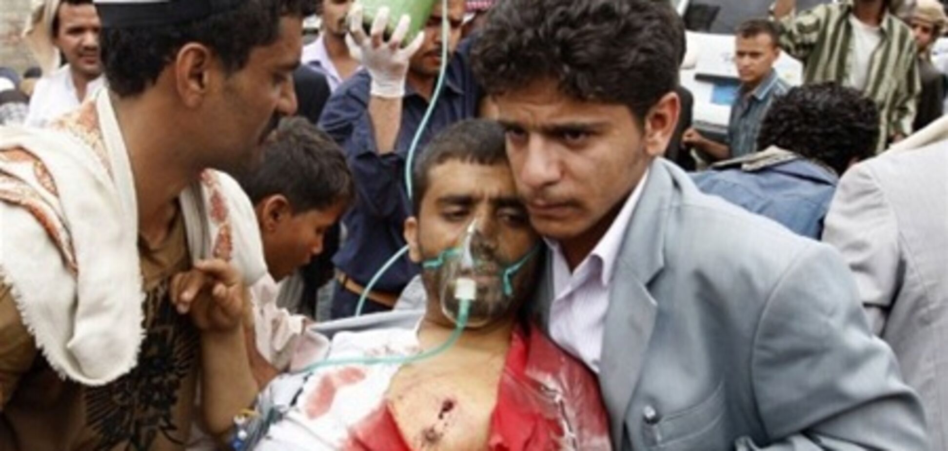 В Йемене президентские войска обстреляли сотни демонстрантов