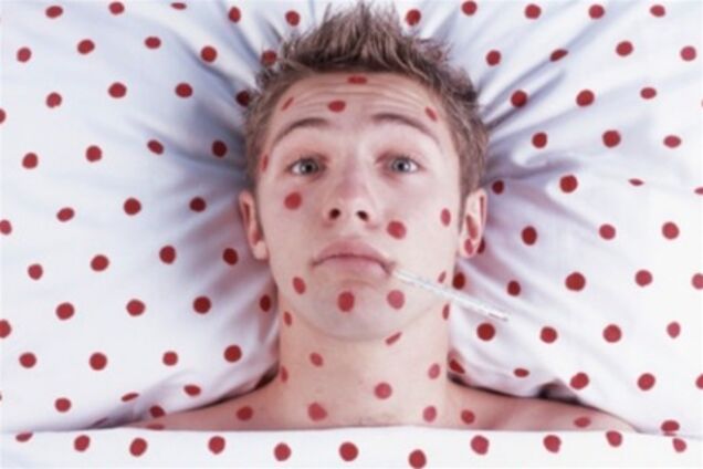 Львівщина. Дітям продовжили канікули через епідемію кору