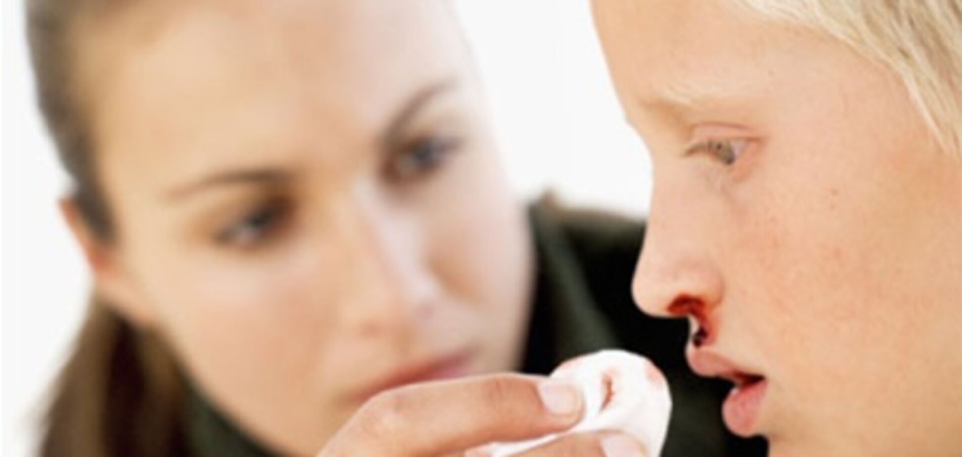 Остановить носовое кровотечение помогает… бекон