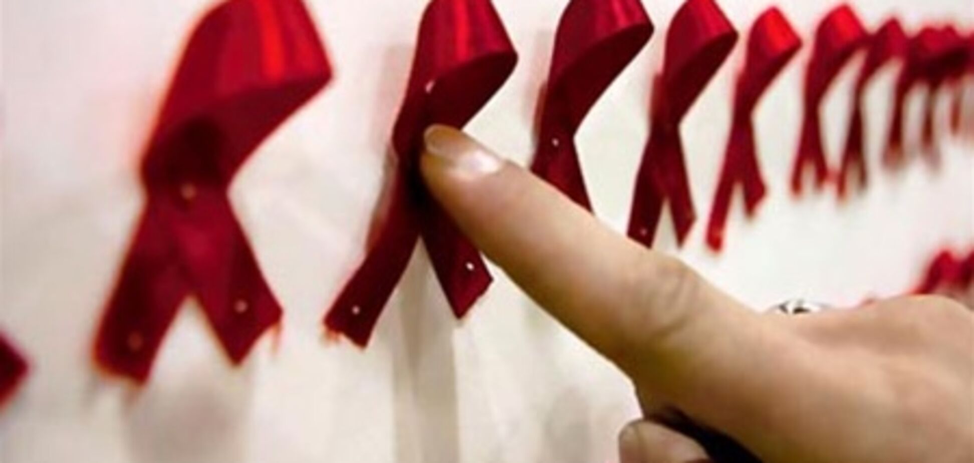 Как распознать ВИЧ-инфекцию по симптомам 