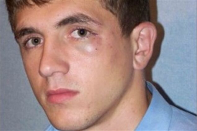 Нападение на кандидата в депутаты в Белой Церкви: возбуждено дело