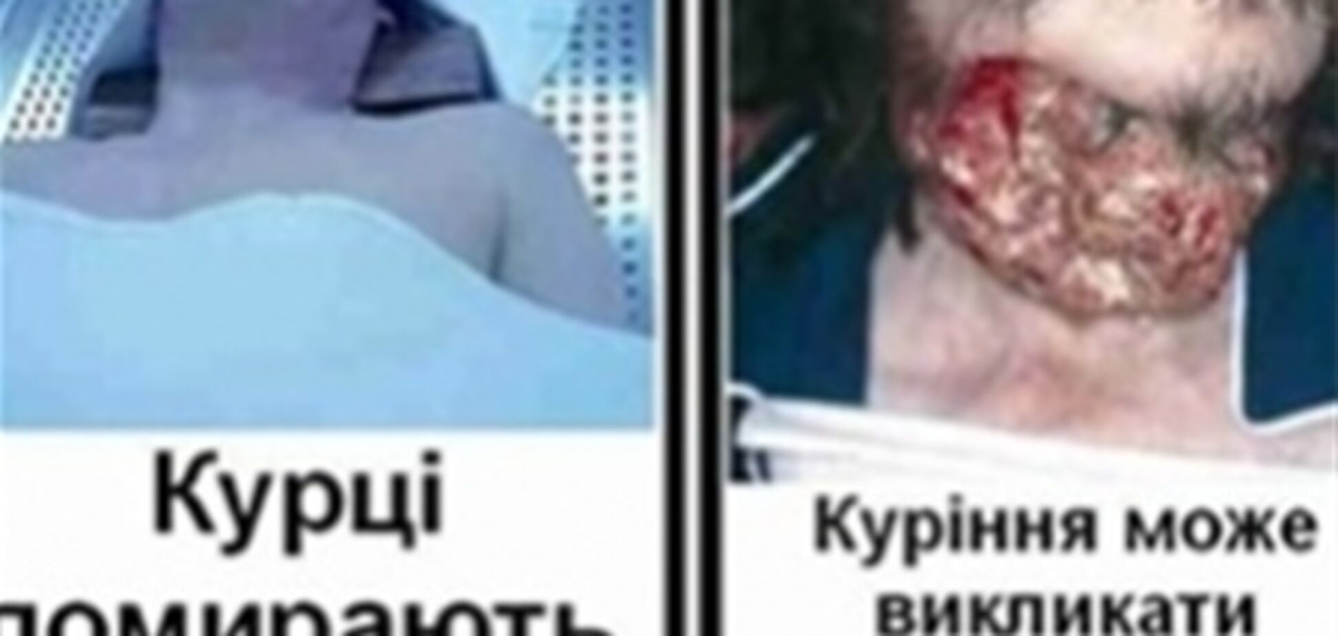 На сигаретных пачках начнут размещать фото внутренних органов, пораженных никотином