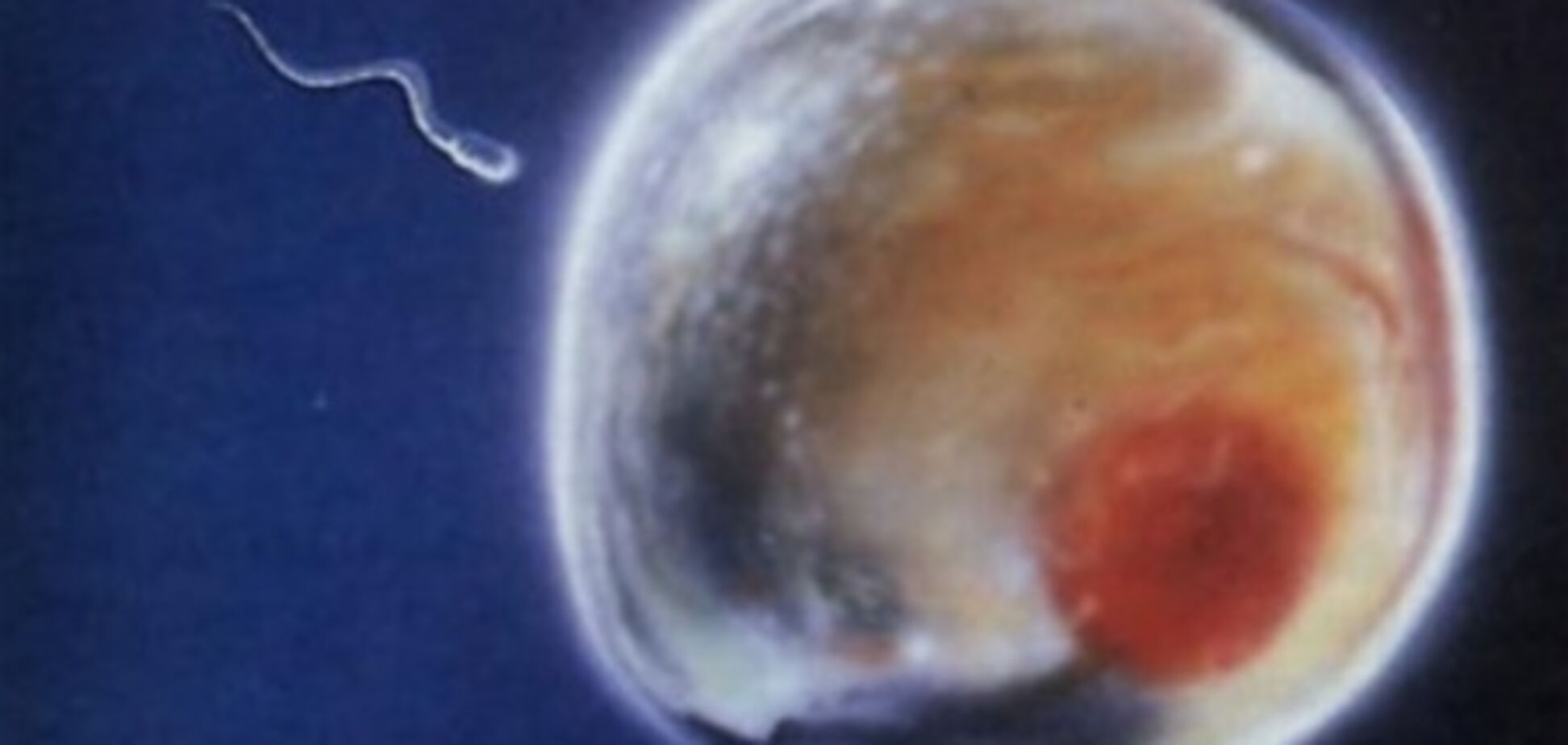 Украинки по дешевке распродают яйцеклетки и рискуют здоровьем