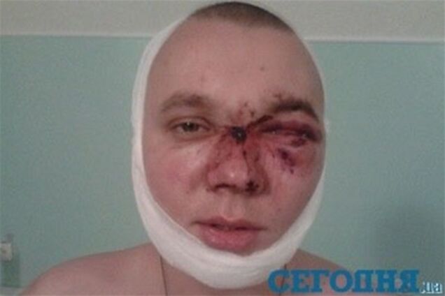 В ночном клубе Кривого Рога охранники жестоко избили посетителя