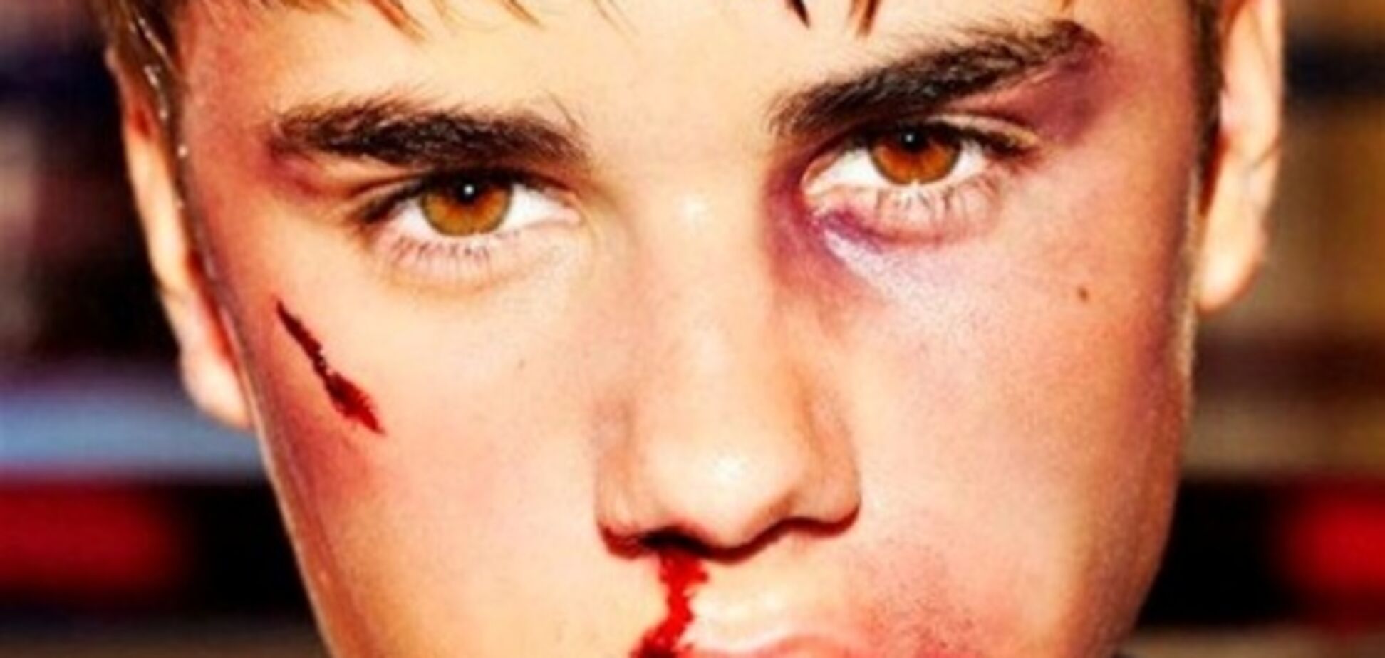 Джастина Бибера чуть не кастрировали