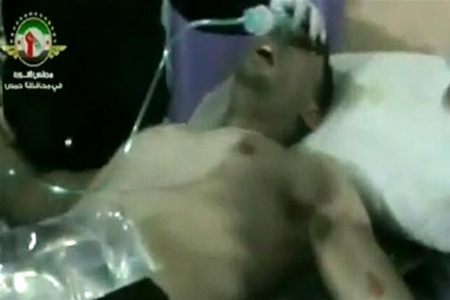 Сирійські повстанці заявили про застосування армією хімзброї