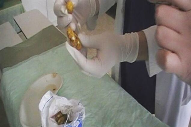 В Одессе задержан контрабандист, перевозивший наркотики в себе