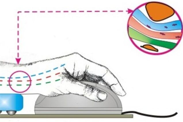 Как предупредить заболевание руки от компьютерной мышки | Обозреватель |  OBOZ.UA