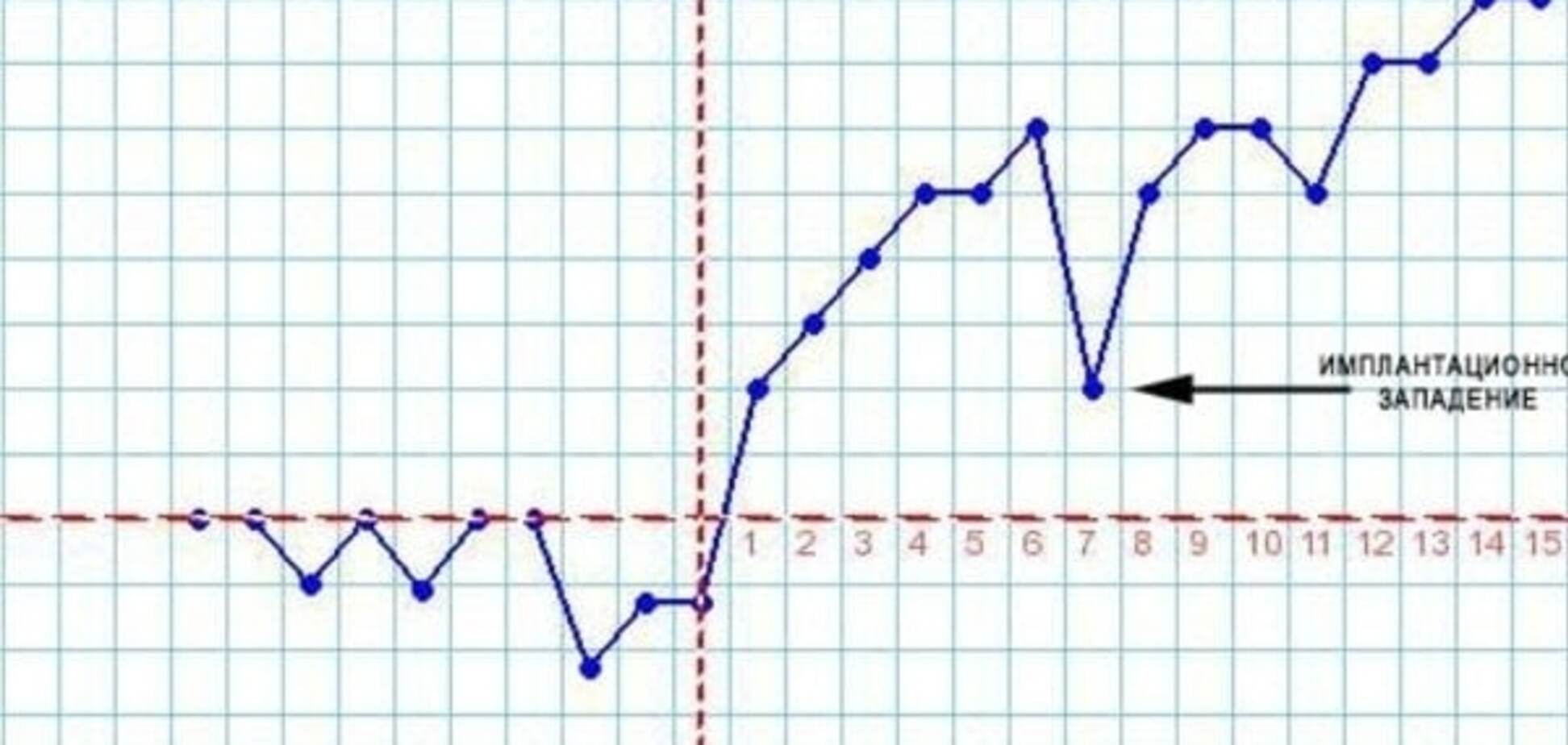 Имплантационное западение – что это?