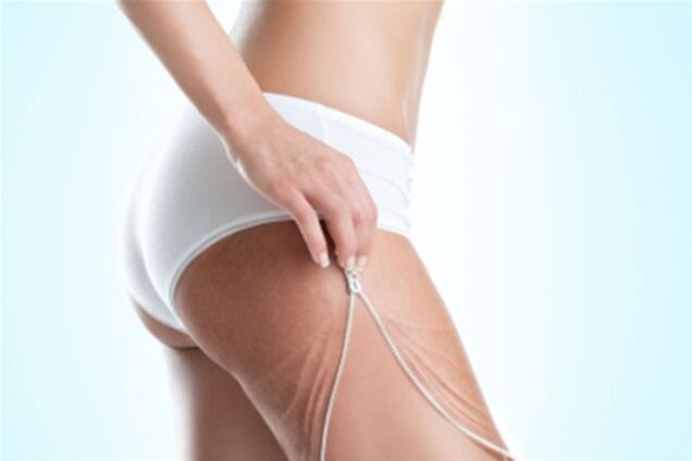 Как убрать самый запущенный целлюлит