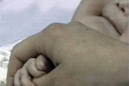 В России 10 детей попали в реанимацию из-за ошибки врачей. Фото