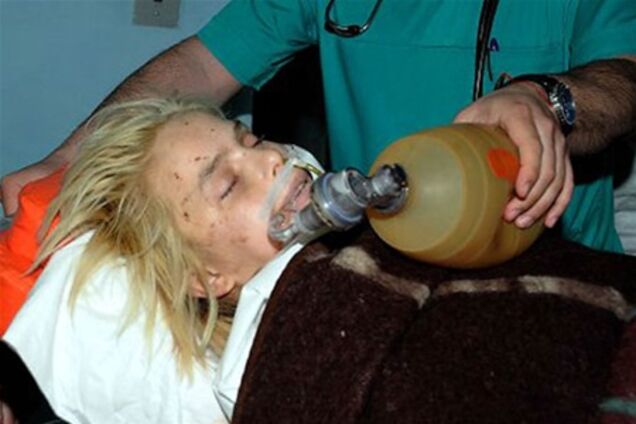 Оксане Макар угрожает сепсис - медики