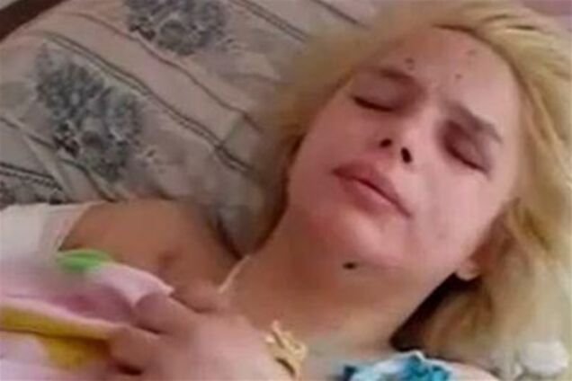 Врачи не исключают у Оксаны Макар патологию головного мозга