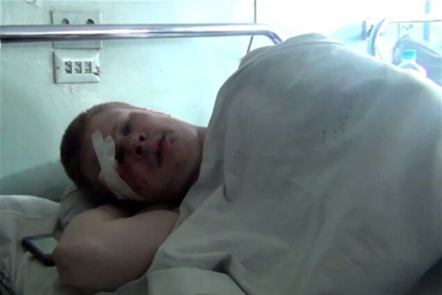 Журналіст 'Дорожнього патруля' розповів про причини нападу. Відео