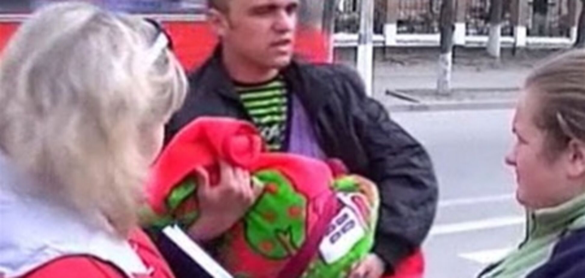 В Кировограде двухмесячной малышке сожгли лицо во время операции. Видео
