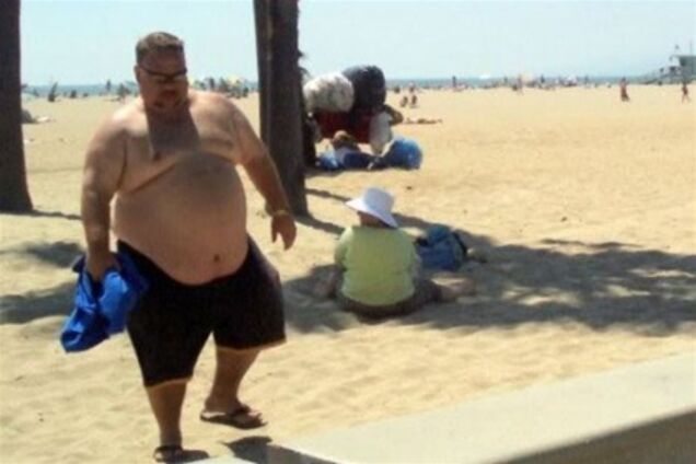 У мужчин тоже есть целлюлит! Где он прячется и откуда берется