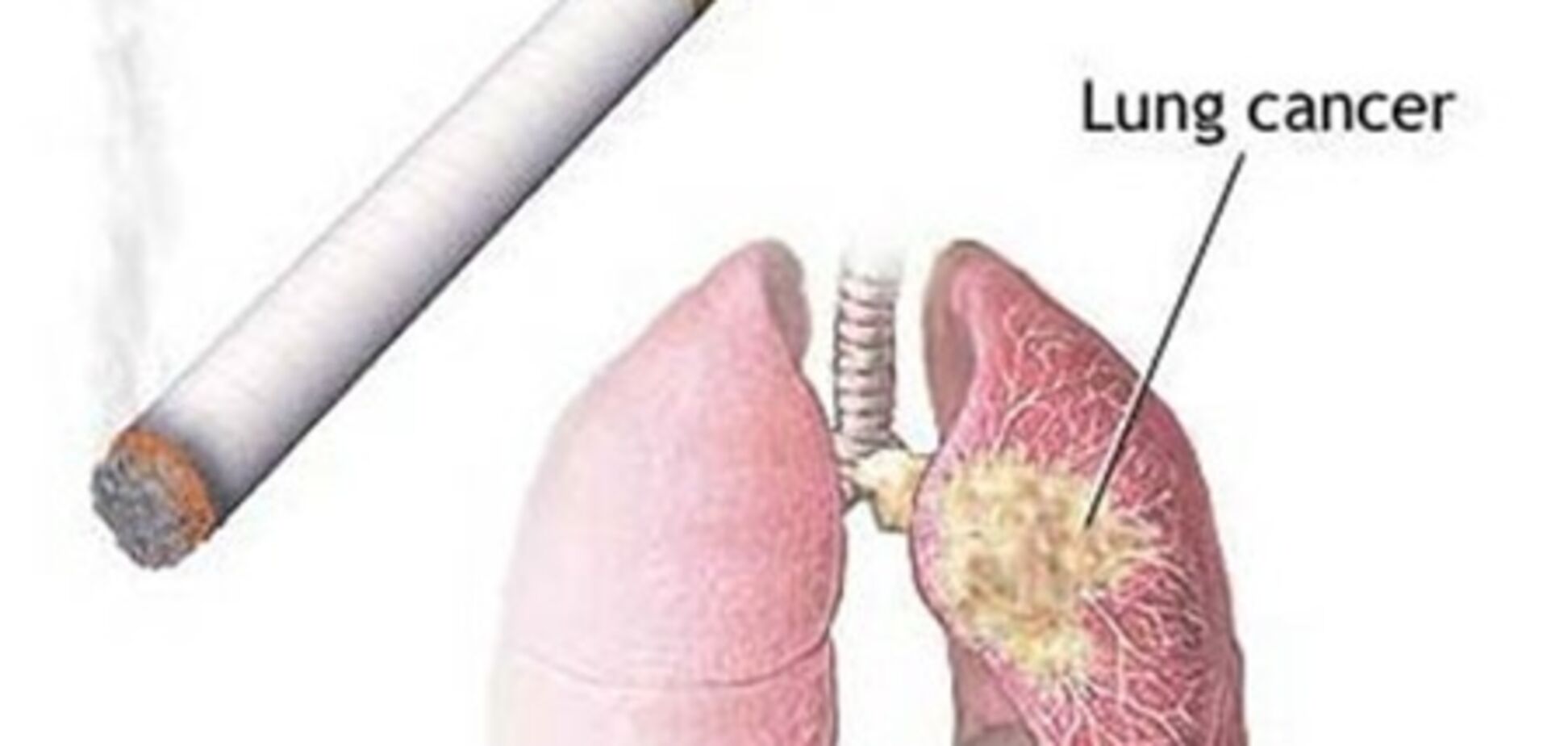 Раскрыт механизм возникновения рака легких при курении