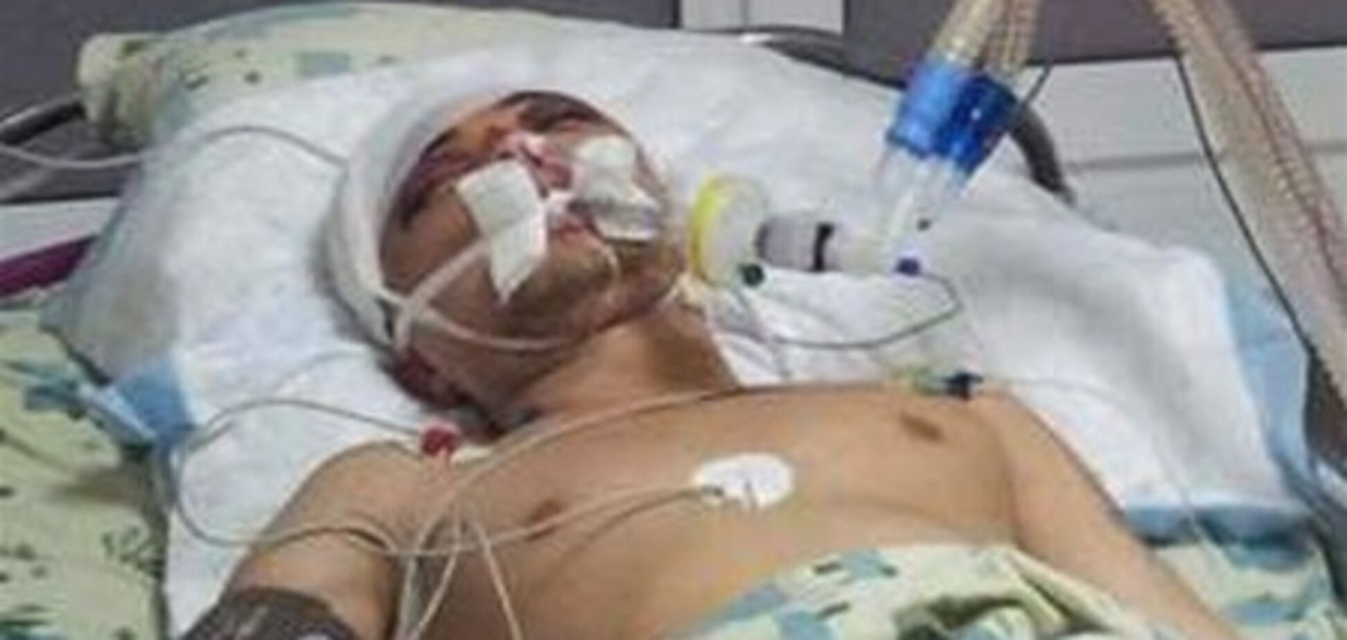 Президент требует найти злоумышленников, избивших студента-еврея